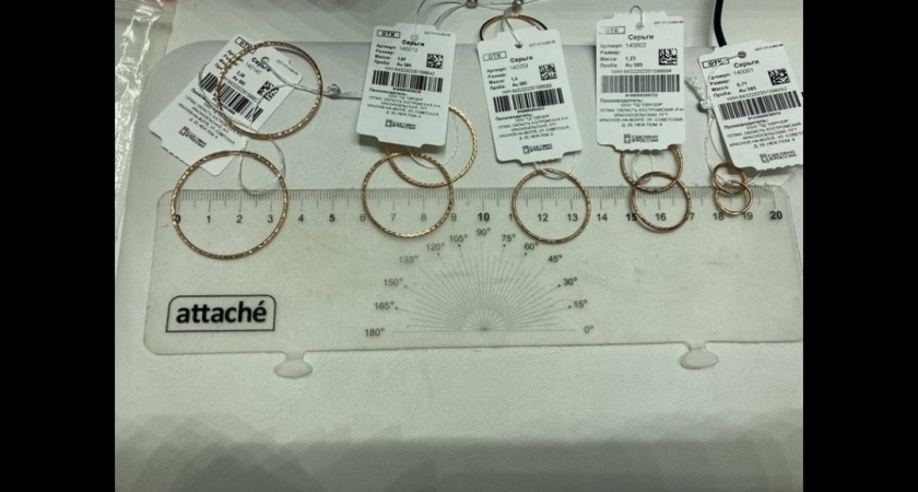 Воронежец едва не лишился пальцев из-за тесных колец