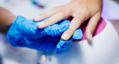 Как ногти кричат о проблеме: "читаем" себя и близких - точнее МРТ и анализов
