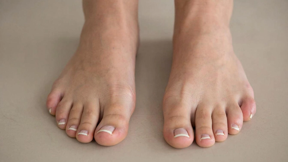 Пятки пемзой больше не шкрябаю – новый тренд в уходе за кожей для стоп