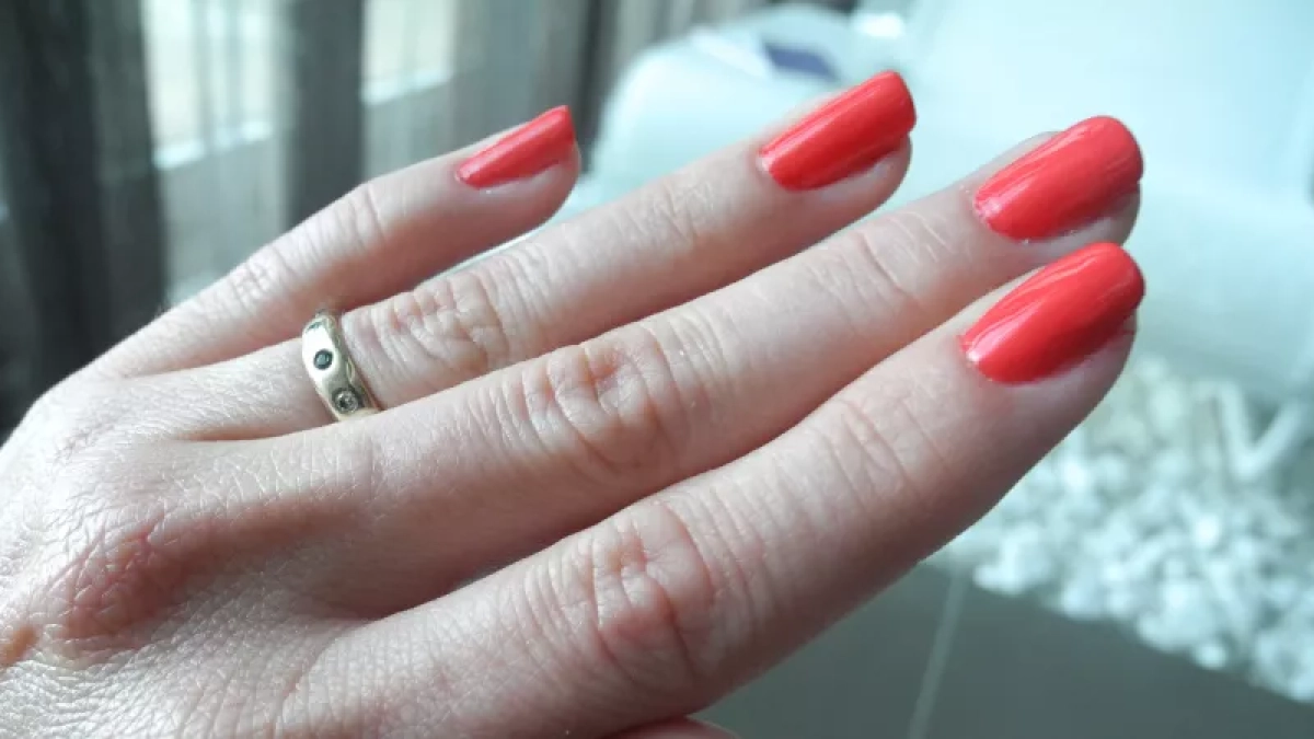 Толстые и жёлтые ногти: обычный фен выручает ноги лучше любых кремов